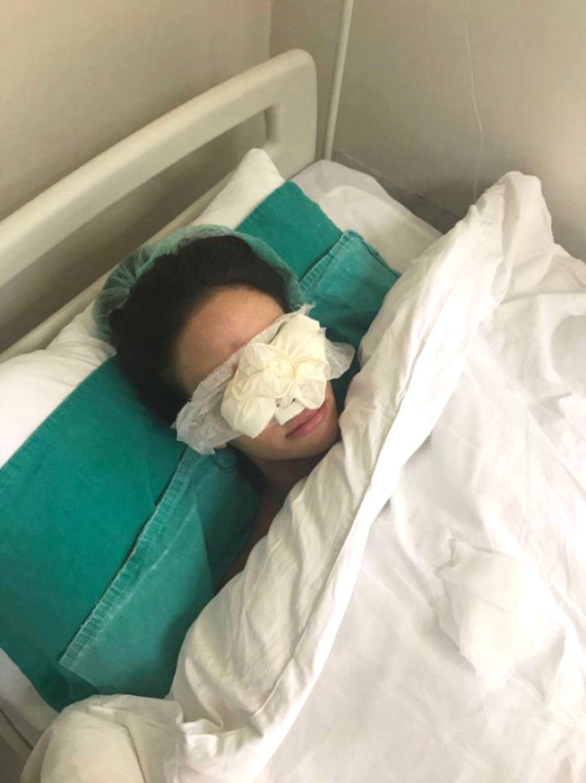 11 YILDA 28 KEZ ESTETİK AMELİYAT OLDU! DÖNÜŞÜMÜ İNANILMAZ galerisi resim 14