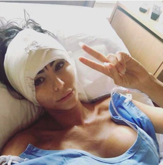 11 YILDA 28 KEZ ESTETİK AMELİYAT OLDU! DÖNÜŞÜMÜ İNANILMAZ galerisi resim 15