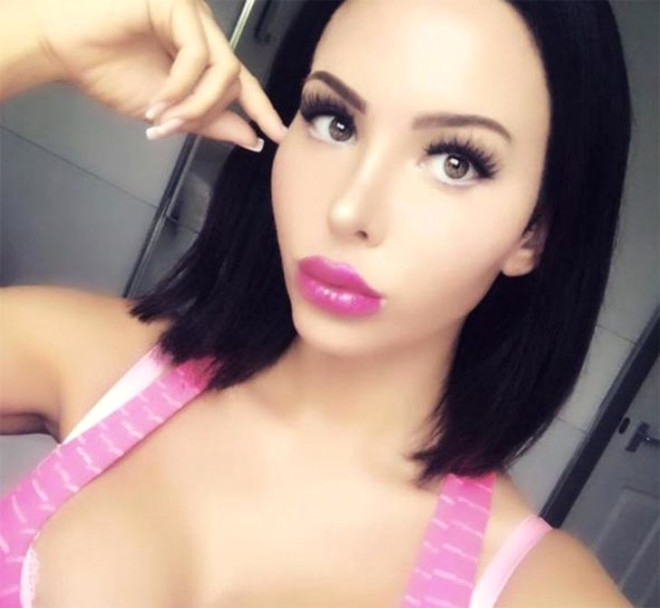 11 YILDA 28 KEZ ESTETİK AMELİYAT OLDU! DÖNÜŞÜMÜ İNANILMAZ galerisi resim 6