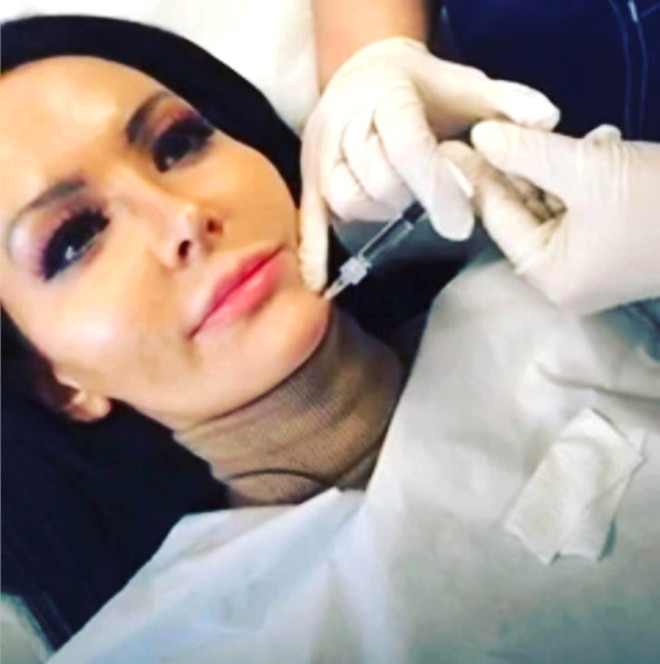 11 YILDA 28 KEZ ESTETİK AMELİYAT OLDU! DÖNÜŞÜMÜ İNANILMAZ galerisi resim 7