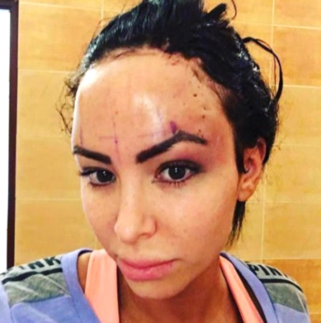 11 YILDA 28 KEZ ESTETİK AMELİYAT OLDU! DÖNÜŞÜMÜ İNANILMAZ galerisi resim 8