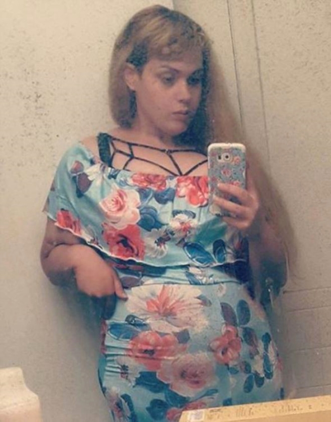 Sevgilisi İle Yatağa Girmek İçin 192 Kilo Verdi galerisi resim 7