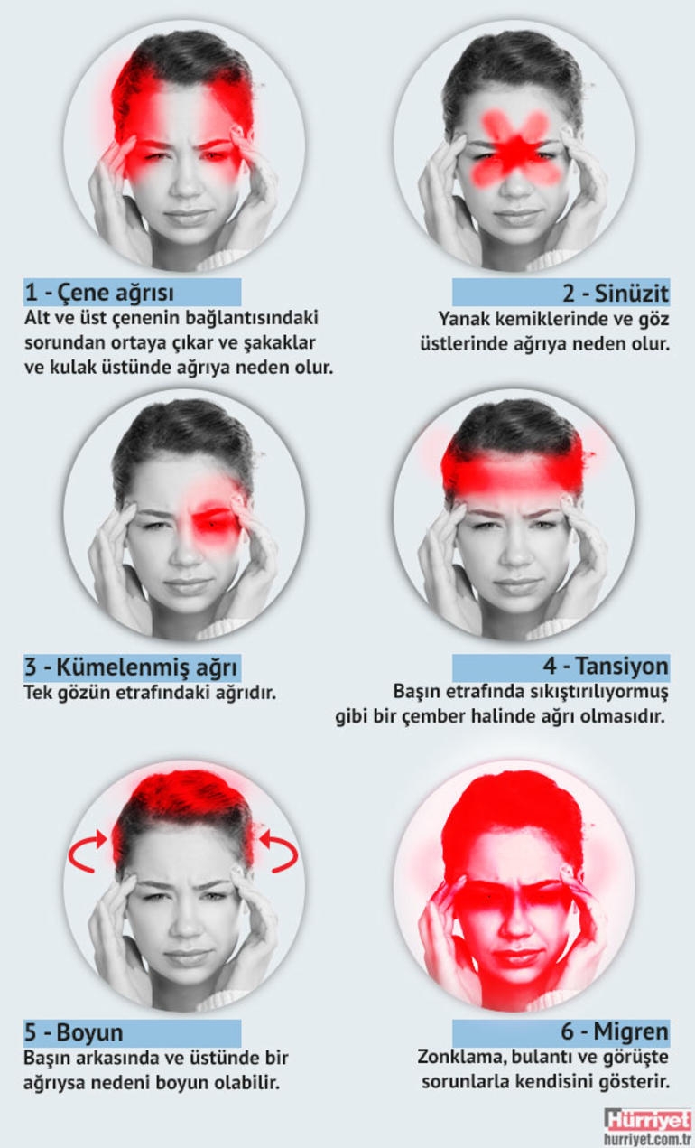Baş ağrısı tipine göre nedenleri galerisi resim 1