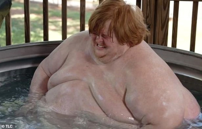 320 kiloluk Obez gencin dramı: Yemek yiyerek öleceğim galerisi resim 1