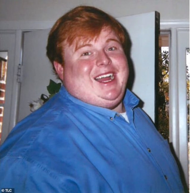 320 kiloluk Obez gencin dramı: Yemek yiyerek öleceğim galerisi resim 2