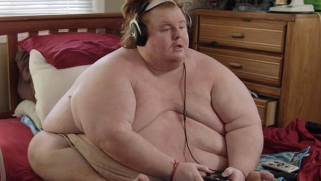 320 kiloluk Obez gencin dramı: Yemek yiyerek öleceğim galerisi resim 3