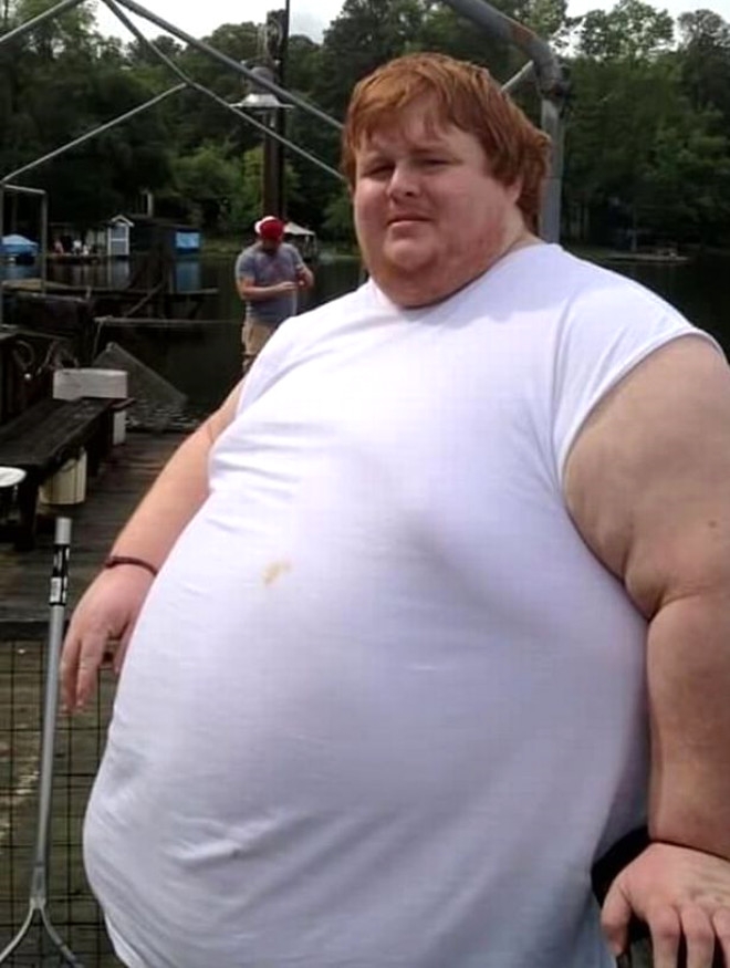 320 kiloluk Obez gencin dramı: Yemek yiyerek öleceğim galerisi resim 5