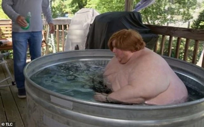 320 kiloluk Obez gencin dramı: Yemek yiyerek öleceğim galerisi resim 6