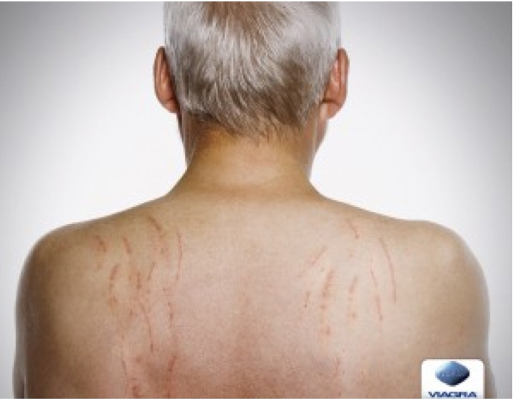 Düşenin Dostu Olan Viagra’nın En Yaratıcı Reklamları galerisi resim 15