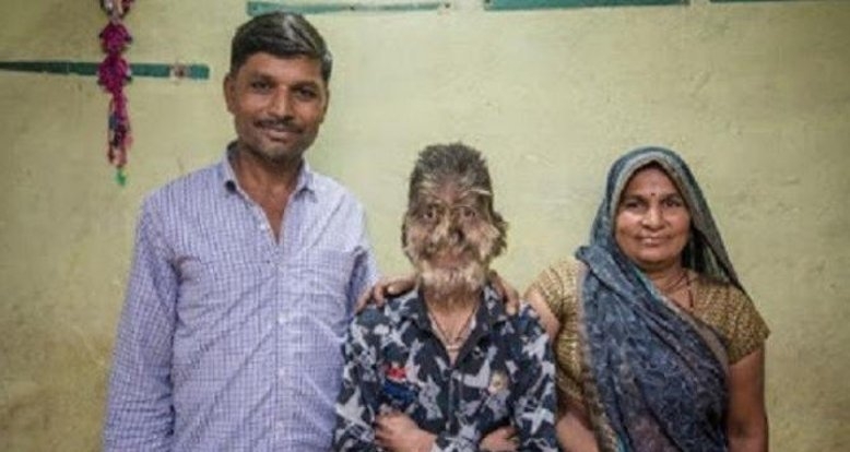 'Kurt adam sendromu'na yakalandı galerisi resim 6