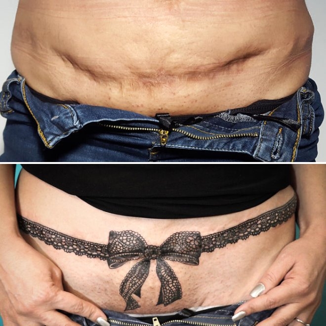 Yara izlerini gizleyen, 30 yaratıcı dövme galerisi resim 2