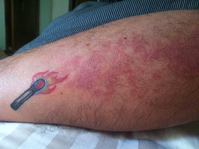 Yara izlerini gizleyen, 30 yaratıcı dövme galerisi resim 5