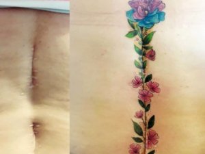 Yara izlerini gizleyen, 30 yaratıcı dövme