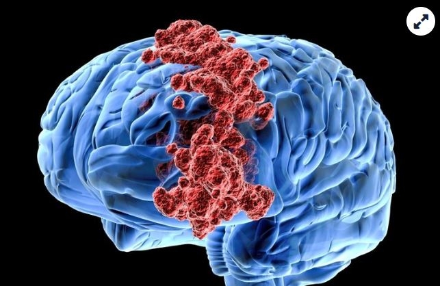 Kafasında büyüyen ‘Gergedan Boynuzu’ hayatını kabusa çevirdi! galerisi resim 10