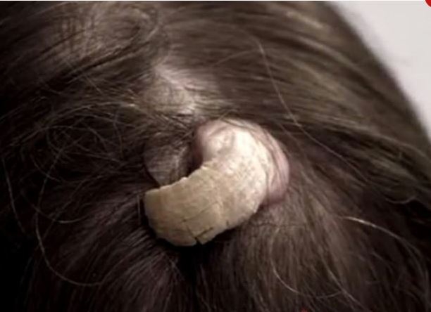 Kafasında büyüyen ‘Gergedan Boynuzu’ hayatını kabusa çevirdi! galerisi resim 3