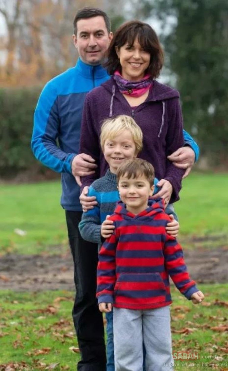 Kafasında büyüyen ‘Gergedan Boynuzu’ hayatını kabusa çevirdi! galerisi resim 5