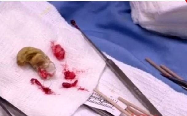 Kafasında büyüyen ‘Gergedan Boynuzu’ hayatını kabusa çevirdi! galerisi resim 6