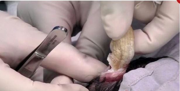 Kafasında büyüyen ‘Gergedan Boynuzu’ hayatını kabusa çevirdi! galerisi resim 7