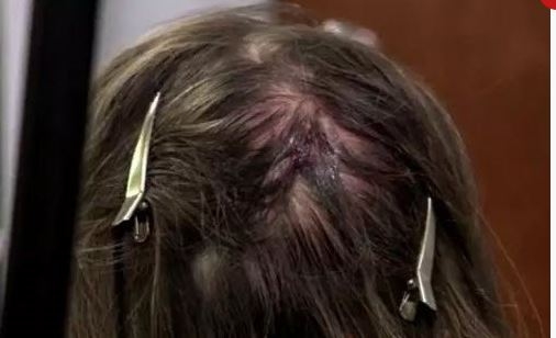 Kafasında büyüyen ‘Gergedan Boynuzu’ hayatını kabusa çevirdi! galerisi resim 9