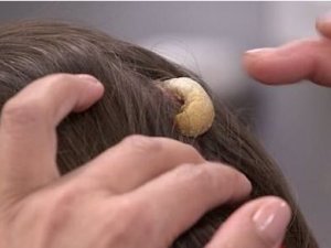 Kafasında büyüyen ‘Gergedan Boynuzu’ hayatını kabusa çevirdi!