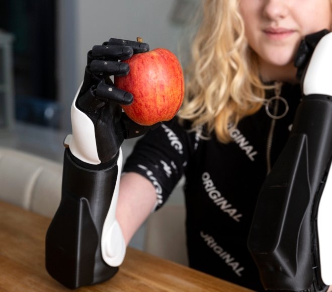 15 aylıkken ellerini kaybetmişti, şimdi makyaj bile yapıyor galerisi resim 8