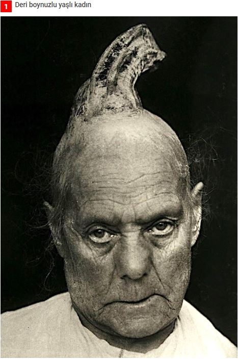 19.yüzyıldan'dan arşivdeki hastalık fotoğrafları galerisi resim 1