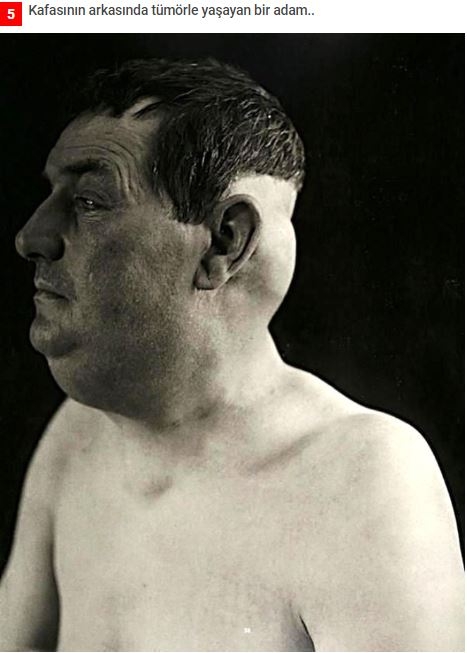 19.yüzyıldan'dan arşivdeki hastalık fotoğrafları galerisi resim 5