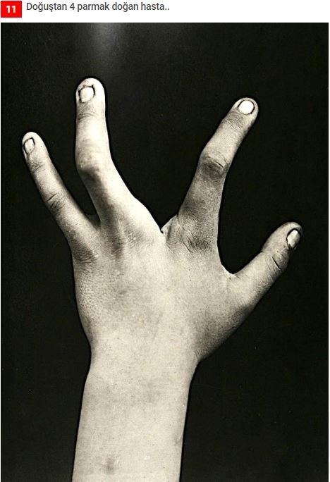 19.yüzyıldan'dan arşivdeki hastalık fotoğrafları galerisi resim 8