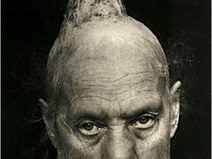 19.yüzyıldan'dan arşivdeki hastalık fotoğrafları