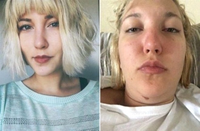 İnstagram'da gördüklerinize inanmayın. Neden mi ? İşte 17 örnek galerisi resim 1