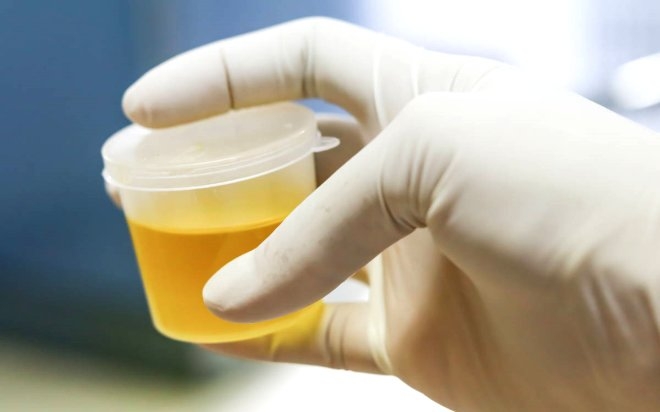 Futbol maçında savaş çıktı, iki bin kişi hayatını kaybetti! galerisi resim 10