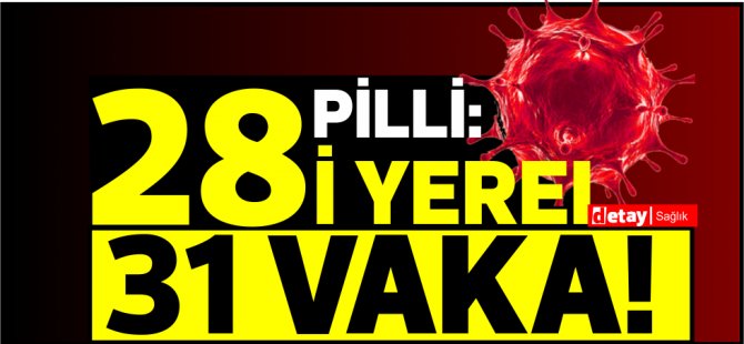 KKTC'de bugün: 28’i yerel 31 pozitif vakaya rastlandı