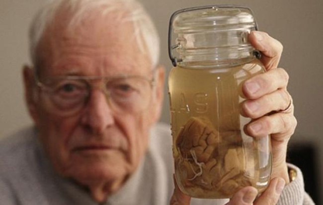 Dünyanın en zeki adamının beyni müzede sergileniyor!