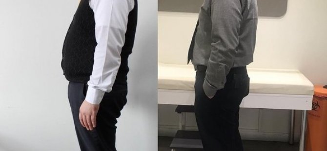 Meslektaşa Tedavi: Obezitede İğne Tedavisiyle 1 Ayda 10 Kilo Verdi - Vimarsana News