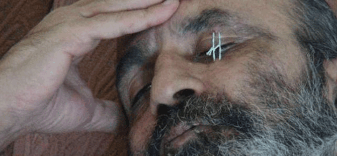 BM'yi protesto için gözünü dikti!