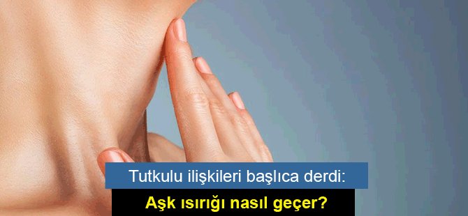 Tutkulu ilişkileri başlıca derdi: Aşk ısırığı nasıl geçer?