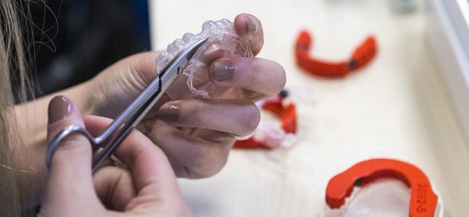 Diş teli tarih oluyor