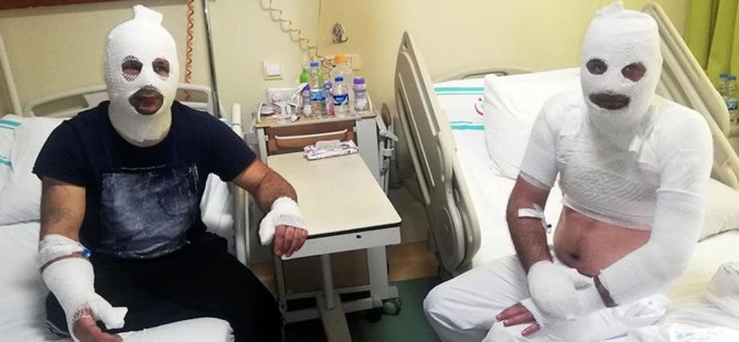 Tinerle temizlik yaparken sigara yakan adam ve arkadaşı alev aldı