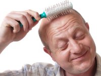 Kelliğe karşı 30 yıl sonra gelen çığır açıcı buluş: Spreylere veda yeni 'saç hapı' son aşamaya geçti