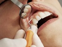 Diş minesini onaran jel geliştirildi: Diş dolgusunun sonu mu geliyor?