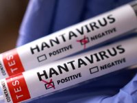 İngiltere: Bir İngiliz vatandaşında daha hantavirüs şüphesi tespit edildi