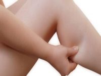 Basit şişlikler lenfödem habercisi olabilir