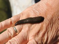 Boğazından 12 santimetrelik canlı sülük çıktı