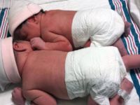 İkizler ama ''aynı yıl'' doğmadılar