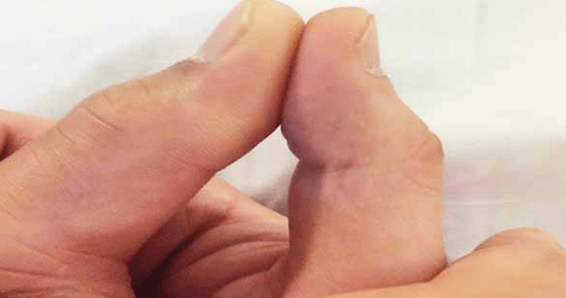 İbrahim Tatlıses'in Uyandıktan Sonraki İlk Fotoğrafı Şaşırttı!