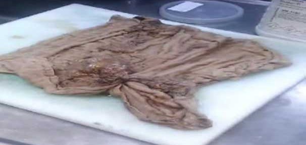 karninda-unutuldu-505-bin-tl-tazminat-davasi-acti--6597711[1]